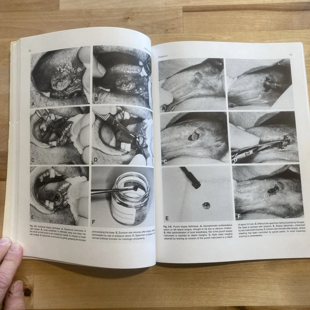 Oral‎ Cancer by Sol Silverman Jr 1985 American Cancer Society Second Edition